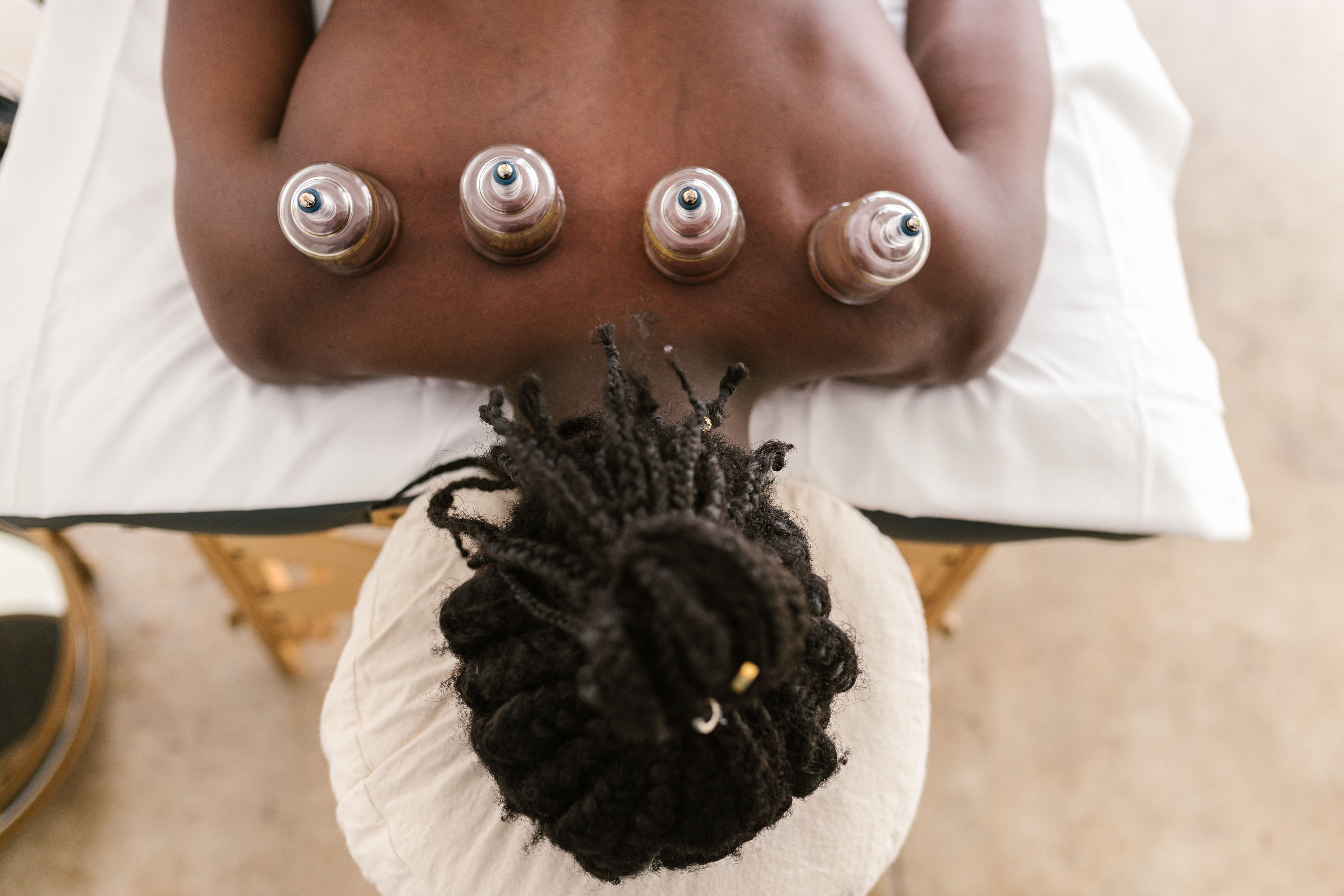 Holistic Dry Cupping